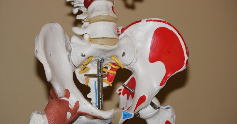 Bursitis trochanterica: Schmerzen an der Hüfte richtig behandeln
